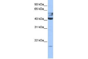 WB Suggested Anti-QTRT1 Antibody Titration:  0. (QTRT1 抗体  (N-Term))