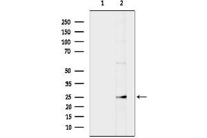 Western blot analysis of lysates from HepG2 cells(serum starvation treatment), using Bak Antibody.