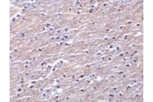 Immunohistochemistry of Clusterin in human brain tissue with Clusterin antibody at 10 μg/ml. (Clusterin 抗体  (Isoform 1))