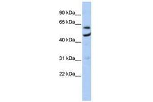 Image no. 1 for anti-CCR4-NOT Transcription Complex, Subunit 6 (CNOT6) (AA 35-84) antibody (ABIN6740696) (CNOT6 抗体  (AA 35-84))