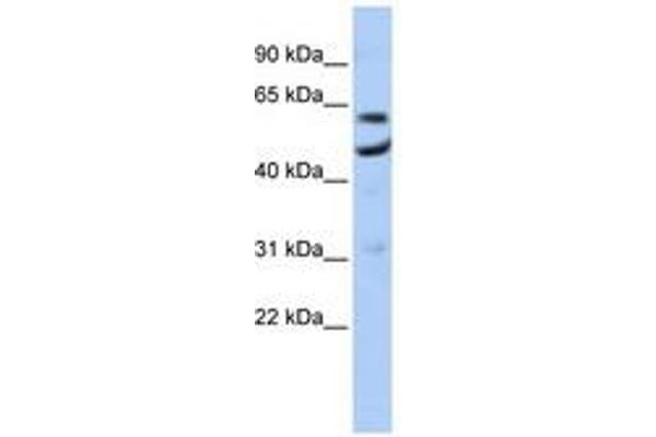 CNOT6 anticorps  (AA 35-84)
