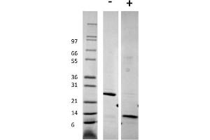 SDS-PAGE of Human Growth and Differentiation Factor-5 Recombinant Protein SDS-PAGE of Human Growth and Differentiation Factor-5 Recombinant Protein. (GDF5 蛋白)