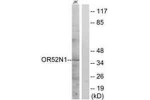 Western blot analysis of extracts from Jurkat cells, using OR52N1 Antibody. (OR52N1 抗体  (AA 269-318))