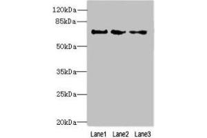 Western blot All lanes: PPIL4 antibody at 4 μg/mL Lane 1: Hela whole cell lysate Lane 2: Mouse kidney tissue Lane 3: HepG2 whole cell lysate Secondary Goat polyclonal to rabbit IgG at 1/10000 dilution Predicted band size: 58 kDa Observed band size: 70 kDa (PPIL4 抗体  (AA 1-492))