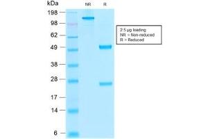 SDS-PAGE analysis of purified, BSA-free recombinant Thrombomodulin antibody (clone rTHBD/1591) as confirmation of integrity and purity. (Thrombomodulin 抗体  (AA 69-194))