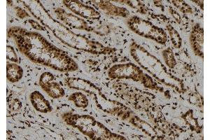 ABIN6278352 at 1/100 staining Human kidney tissue by IHC-P. (ARL4A 抗体  (Internal Region))