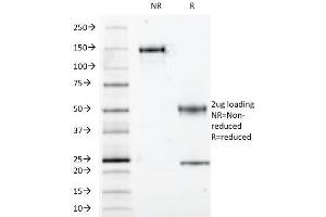 SDS-PAGE Analysis S100B Mouse Monoclonal Antibody (S100B/1012). (S100B 抗体)