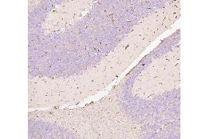 IHC analysis of SLC2A1 using anti-SLC2A1 antibody (ABIN3043927).