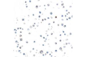 Immunocytochemistry (ICC) image for anti-Selectin P (Granule Membrane Protein 140kDa, Antigen CD62) (SELP) (AA 42-771) antibody (ABIN7795665)