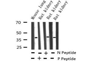 Western blot analysis of Phospho-c-Jun (Tyr170) expression in various lysates (C-JUN 抗体  (pTyr170))