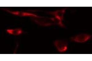 ABIN6275441 staining  NIH-3T3 cells by IF/ICC. (RFTN1 抗体  (Internal Region))