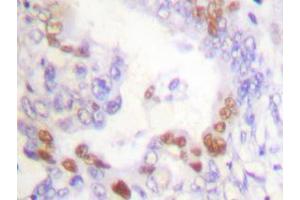 Image no. 1 for anti-Fanconi Anemia, Complementation Group D2 (FANCD2) antibody (ABIN265413) (FANCD2 抗体)
