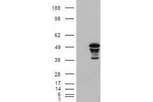 HEK293T cells were transfected with the pCMV6-ENTRY control (Left lane) or pCMV6-ENTRY FOXA2 (RC211408) (Right lane) cDNA for 48 hrs and lysed. (FOXA2 抗体  (AA 300-458))