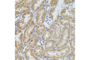 Immunohistochemistry of paraffin-embedded rat kidney using MMP10 antibody (ABIN5971553) at dilution of 1/100 (40x lens). (MMP10 抗体)
