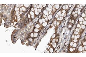 ABIN6267378 at 1/100 staining Rat colon tissue by IHC-P. (NCF1 抗体  (pSer359))