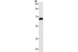 Gel: 10 % SDS-PAGE, Lysate: 40 μg, Lane: Mouse liver tissue, Primary antibody: ABIN7192428(SLC22A3 Antibody) at dilution 1/400, Secondary antibody: Goat anti rabbit IgG at 1/8000 dilution, Exposure time: 1 minute (SLC22A3 抗体)