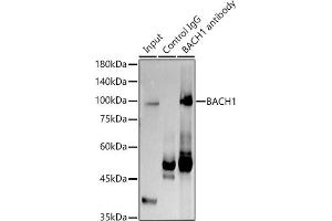 Immunoprecipitation analysis of 300 μg extracts of K-562 cells using 3 μg B antibody (ABIN7265956).