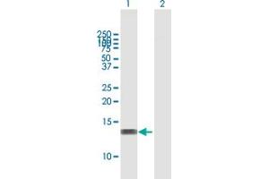 Western Blot analysis of RBBP6 expression in transfected 293T cell line by RBBP6 MaxPab polyclonal antibody. (RBBP6 抗体  (AA 1-118))