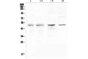 Western blot analysis of CFP using anti-CFP antibody (ABIN6719298).