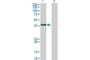 Western Blot analysis of UROD expression in transfected 293T cell line by UROD monoclonal antibody (M01A), clone 1G4. (UROD 抗体  (AA 268-367))