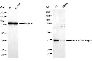 Western blotting analysis using NFKB inhibitor alpha antibody (ABIN7799643).