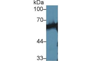 Western blot analysis of Mouse Skeletal muscle lysate, using Human CaN Antibody (1 µg/ml) and HRP-conjugated Goat Anti-Rabbit antibody (