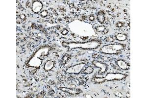 IHC analysis of METTL1 using anti-METTL1 antibody (ABIN7600484). (METTL1 抗体  (AA 2-276))