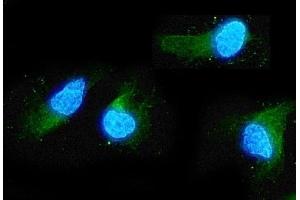 IF analysis of ADO using anti-ADO antibody (ABIN4886431).
