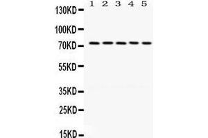 Western Blotting (WB) image for anti-LIM Domain Kinase 1 (LIMK1) (AA 599-634), (C-Term) antibody (ABIN3043411)