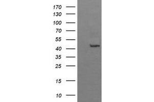 Image no. 1 for anti-butyrobetaine (Gamma), 2-Oxoglutarate Dioxygenase (Gamma-butyrobetaine Hydroxylase) 1 (BBOX1) antibody (ABIN1496816) (BBOX1 抗体)