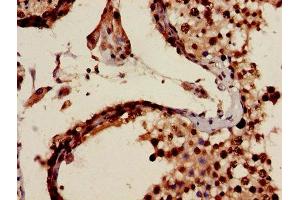 Immunohistochemistry of paraffin-embedded human testis tissue using ABIN7159300 at dilution of 1:100 (MIA 抗体  (AA 87-124))