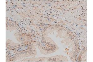 Immunohistochemistry (IHC) image for anti-cAMP Responsive Element Binding Protein 1 (CREB1) (pSer142) antibody (ABIN6254981)
