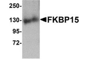 Western Blotting (WB) image for anti-FK506 Binding Protein 15, 133kDa (FKBP15) (N-Term) antibody (ABIN1031380) (FKBP15 抗体  (N-Term))