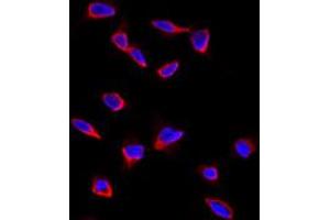 Immunofluorescence analysis of CD9 polyclonal antibody  in HeLa cells. (CD9 抗体  (Internal Region))