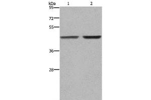 Western Blot analysis of MCF-7 and 231 cell using GABPB2 Polyclonal Antibody at dilution of 1:550 (GABPB2 抗体)