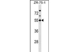 KCNJ1 Antibody (C-term) (ABIN1537138 and ABIN2850385) western blot analysis in ZR-75-1 cell line lysates (35 μg/lane). (KCNJ1 抗体  (C-Term))