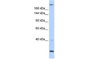 WB Suggested Anti-TNRC6B Antibody Titration:  0. (TNRC6B 抗体  (N-Term))