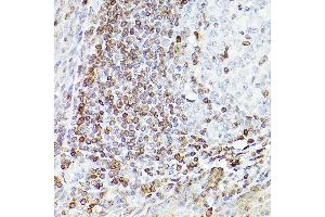 Immunohistochemistry of paraffin-embedded Human tonsil(400X) using Bcl-2 antibody (ABIN7265810) at dilution of 1:100 (40x lens).