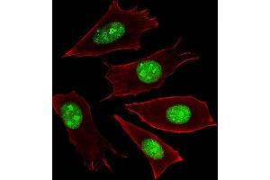 Fluorescent image of NIH/3T3 cells stained with RN Antibody (Center) C. (RNF166 抗体  (AA 71-97))