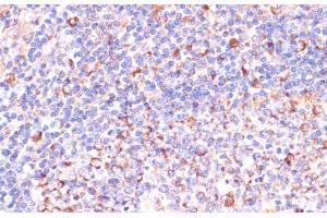 Immunohistochemistry of paraffin-embedded Human tonsil using VHL Polyclonal Antibody at dilution of 1:200 (40x lens). (VHL 抗体)