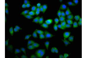 Immunofluorescence staining of Hela cells with ABIN7150346 at 1:100, counter-stained with DAPI. (TOP2B 抗体  (AA 1400-1626))