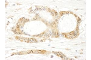 Immunohistochemistry (IHC) image for anti-Yes-Associated Protein 1 (YAP1) (AA 350-400) antibody (ABIN7449039)