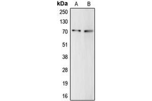 Western blot analysis of Complement C9 expression in HepG2 (A), THP1 (B) whole cell lysates. (C9 抗体  (Center))