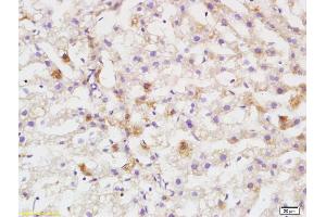 Formalin-fixed and paraffin embedded rat liver labeled with Anti DEPTOR/DEPDC6 Polyclonal Antibody, Unconjugated (ABIN1387597) at 1:200 followed by conjugation to the secondary antibody and DAB staining (DEPTOR 抗体  (AA 56-170))