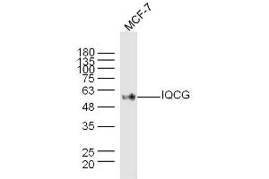 MCF-7 lysates probed with IQCG Polyclonal Antibody, Unconjugated  at 1:300 dilution and 4˚C overnight incubation. (IQCG 抗体)