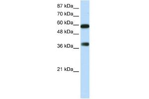 WB Suggested Anti-ARID3B Antibody Titration:  0. (ARID3B 抗体  (C-Term))