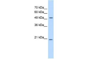 WB Suggested Anti-GCNT4 Antibody Titration:  0. (GCNT4 抗体  (C-Term))