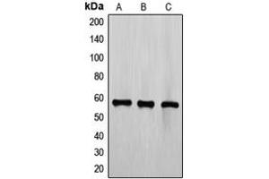 Western blot analysis of TEL expression in CCRFCEM (A), Jurkat (B), K562 (C) whole cell lysates. (ETV6 抗体  (C-Term))