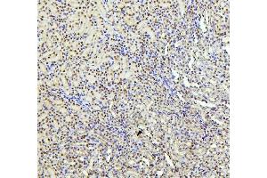 IHC analysis of PTBP1 using anti-PTBP1 antibody (ABIN7599451).