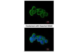 ICC/IF Image Immunofluorescence analysis of methanol-fixed A431, using FLRT1, antibody at 1:200 dilution. (FLRT1 抗体)